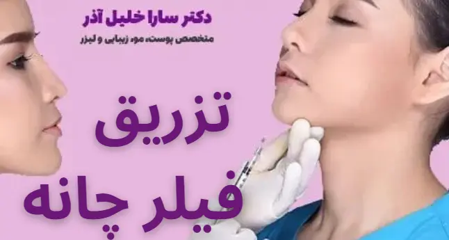 تزریق فیلر چانه