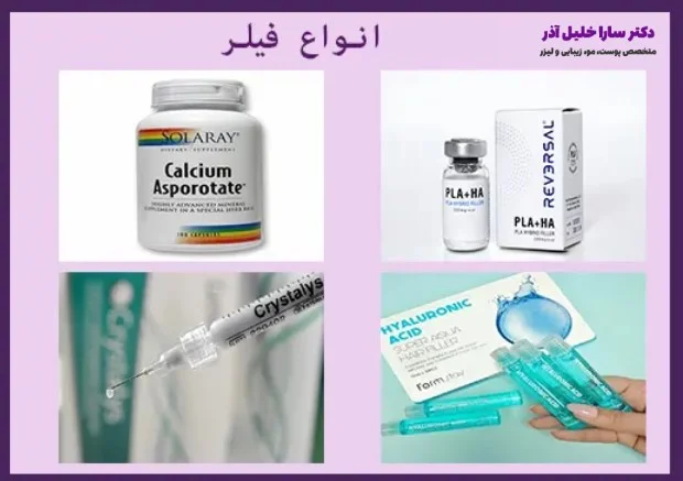 انواع فیلر