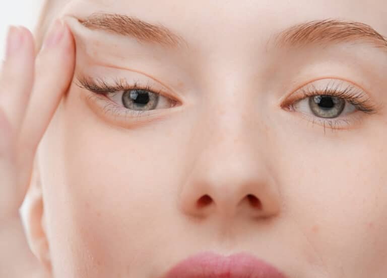 تصویر شاخص بوتاکس چشم گربه ای