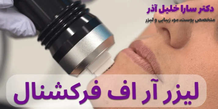 لیزر آر اف فرکشنال