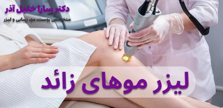 لیزر موهای زائد