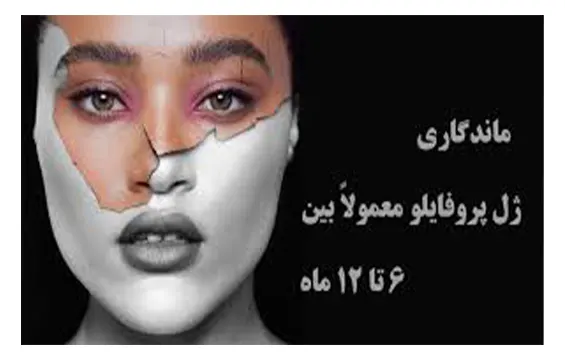 ماندگاری پروفایلو