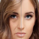 بالاکشیدن صورت میدفیس