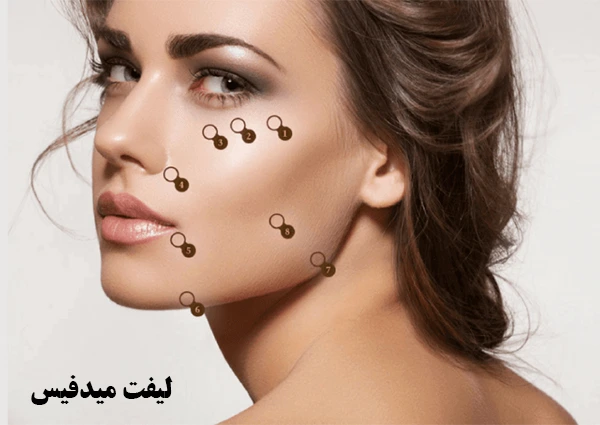 لیفت میدفیس