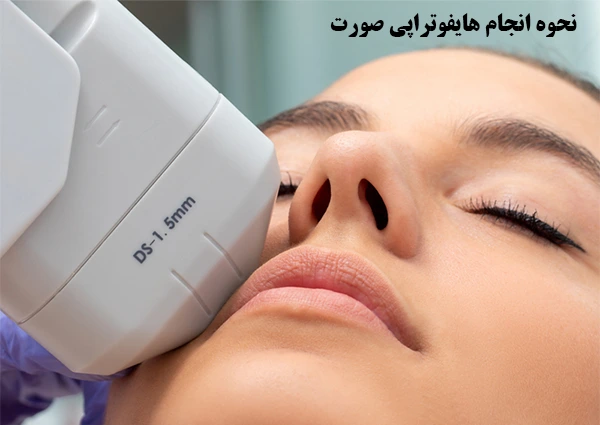 نحوه انجام هایفوتراپی صورت