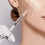 مزوتراپی چربی سوز غبغب، روشی برای رفع چربی زیر چانه
